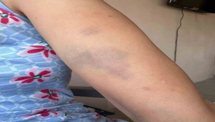 Veteriner ve ailesine ‘Sokak köpeklerini besledin dayağı iddiası