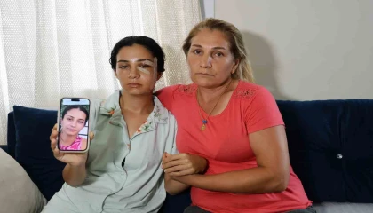 Eski eşinden şiddet gören kadın: Ben yaşarken kurtulayım, öldükten sonra değil