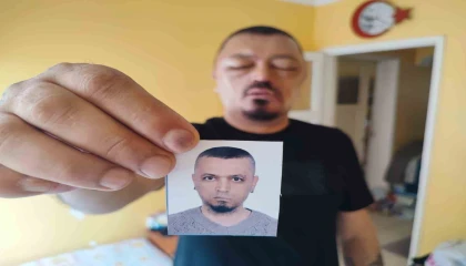 Saçlarını siyahlatmak için aldığı şampuan arı sokmasından beter hale getirdi