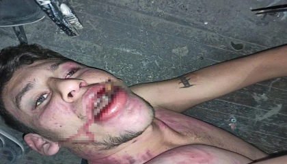 Antalyada Böcek yedirip dişlerimi kırdılar iddiasına 20 yıl hapis talebi