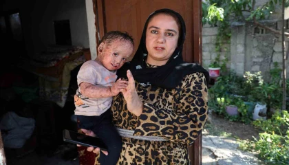 Balık pulu ve kelebek hastası Yusufun yardım paralarını dolandırıcılar topladı