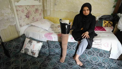 Kahramanmaraş merkezli büyük depremde bacağını kaybetti, eşi terk etti