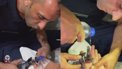 Parmağına yüzük sıkışan vatandaşın imdadına itfaiye ekipleri yetişti