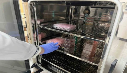 Parkinsonda bağırsak- beyin iletişimi çip üstü organ teknolojisiyle araştırılıyor