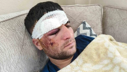 Döner ustası motosiklet sürücüsü: Kaza sonrası kaçıp gittiler