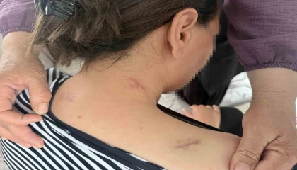 17 bıçak darbesi aldı, ölü numarasıyla kurtuldu, kocasının en ağır cezayı almasını istedi