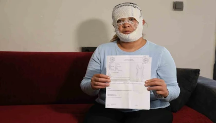 Güzelleşmek uğruna gittiği merkezde yüzü yandı