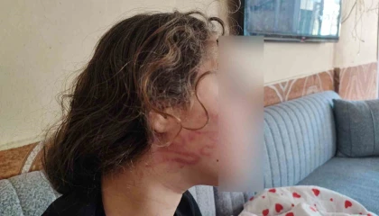 8 yaşındaki kızını darp eden çocuğun epilepsi hastası ablasını sokak ortasında dövdüğü iddiası