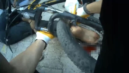 Osmaniyede ayağı bisikletin tekerine sıkışan çocuk ekiplerce kurtarıldı