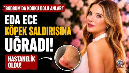 Köpek saldırısına uğrayan Eda Ece hastanelik oldu