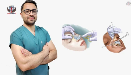 BURUN AMELİYATINDA ESTETİK VE  FONKSİYON BİRLİKTE DEĞERLENDİRİLMELİ