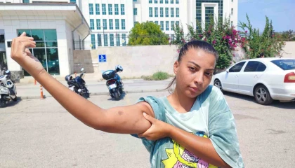 Cankurtaran kadın, öğretmen amcası tarafından darp edildi