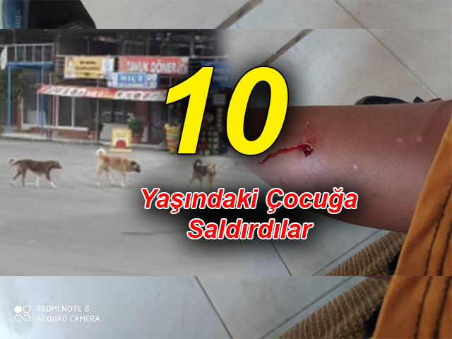 Hatay'da Sokak Köpekleri Çocuğa Saldırdı