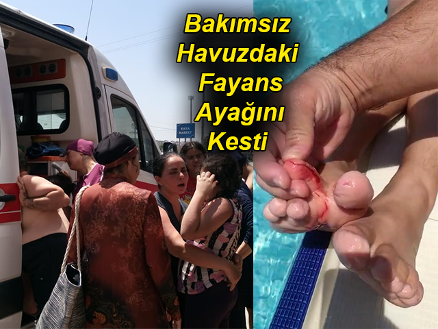 Bakımsız Havuzdaki Fayans Ayağını Kesti 
