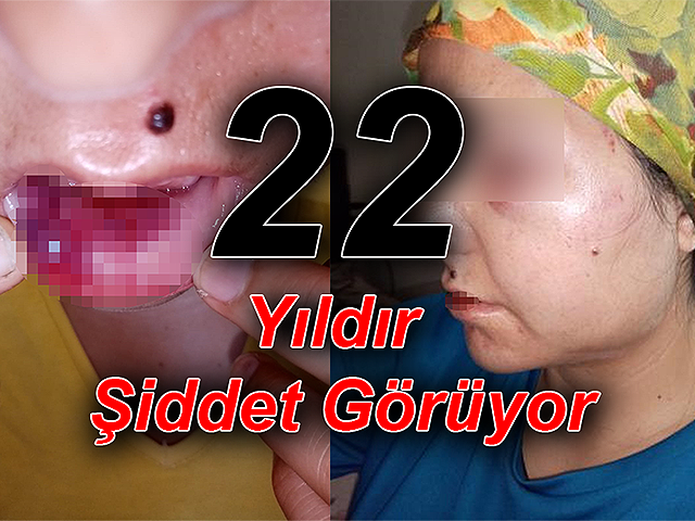 Hatay'da 22 Yıldır Şiddet Gören Kadın Baba Evine Sığındı