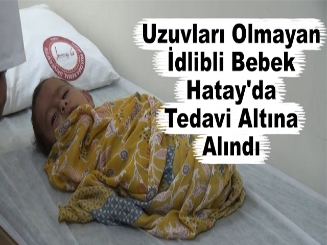 Uzuvları Olmayan İdlibli Bebek Hatay'da Tedavi Altına Alındı