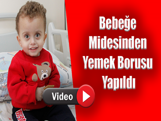 Hatayda bebeğe midesinden yemek borusu yapıldı